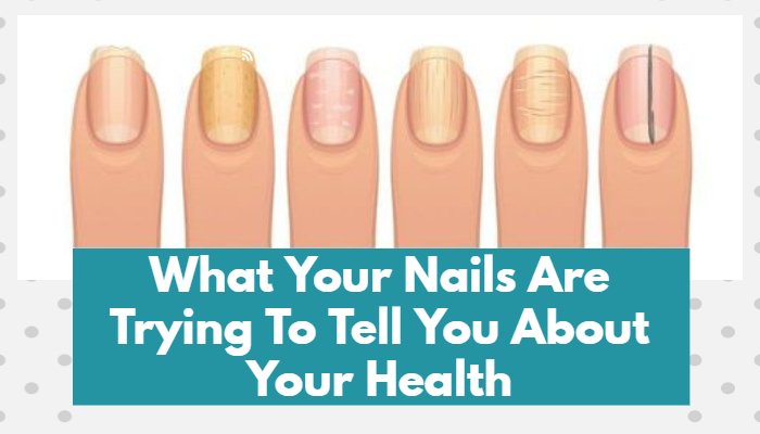 What Your Nails Are Trying To Tell You About Your Health